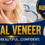 Foto del perfil de veneers vietnam