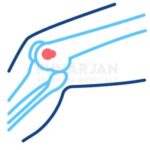 Foto del perfil de Bone Cancer Hyderabad
